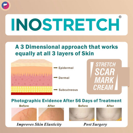 Inostretch-1.jpg-filenameUTF-8Inostretch201.jpg Inostretch-1.jpg-filenameUTF-8Inostretch201.jpg