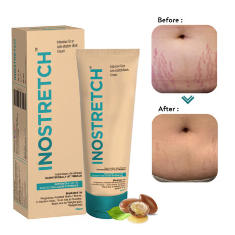 Inostretch-a.jpg-filenameUTF-8Inostretch-a.jpg Inostretch-a.jpg-filenameUTF-8Inostretch-a.jpg